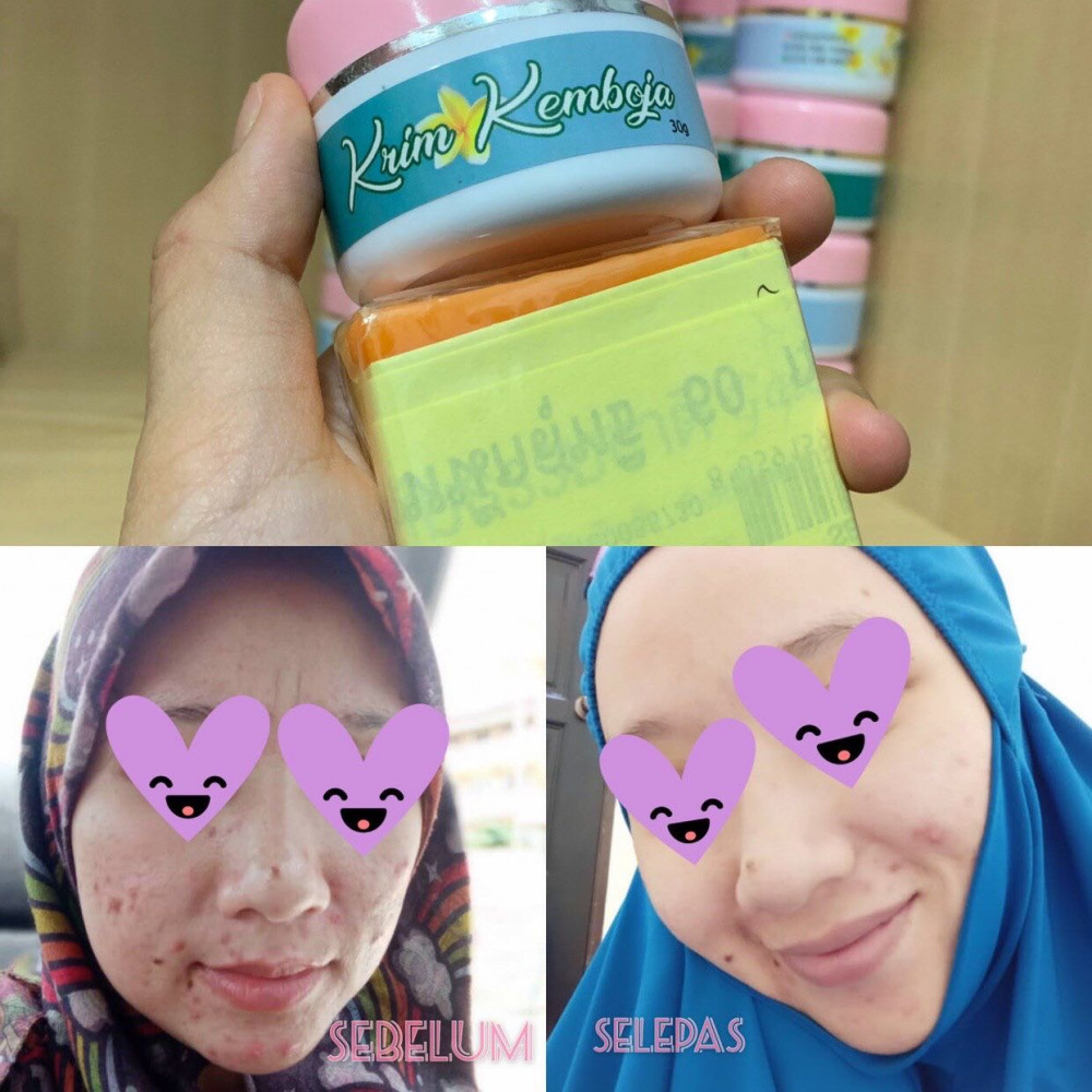 KRIM KEMBOJA Free Sabun Oren Original KRIM KEMBOJA Free Sabun Oren Original